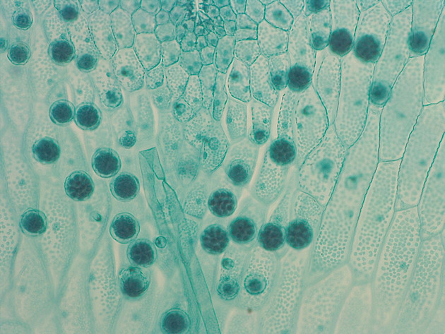 Fern Gametophyte Slides - Ferngametophyte 03 200X